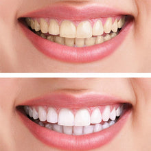 Load image into Gallery viewer, 🥳Hydroxyapatite Toothpaste