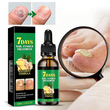 Load image into Gallery viewer, Ginger Nail Treatment