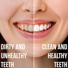 Load image into Gallery viewer, 🥳Hydroxyapatite Toothpaste