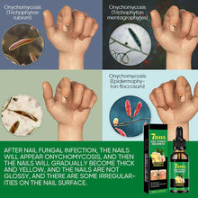 Load image into Gallery viewer, Ginger Nail Treatment