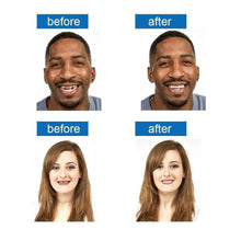 Load image into Gallery viewer, Latest👨‍⚕Adjustable Snap-On Dentures😁 (💥50% OFF) - 🔥HOT SALE🔥🎉