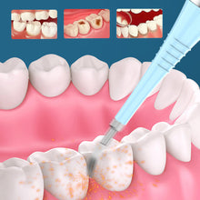 Load image into Gallery viewer, Electric Dental Scaler Dental Calculus Remover