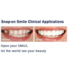 Load image into Gallery viewer, Latest👨‍⚕Adjustable Snap-On Dentures😁 (💥50% OFF) - 🔥HOT SALE🔥🎉