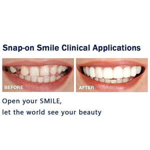 Latest👨‍⚕Adjustable Snap-On Dentures😁 (💥50% OFF) - 🔥HOT SALE🔥🎉