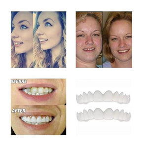 Latest👨‍⚕Adjustable Snap-On Dentures😁 (💥50% OFF) - 🔥HOT SALE🔥🎉