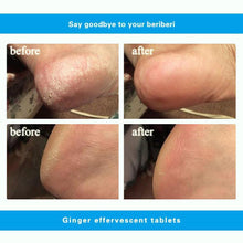 Load image into Gallery viewer, Anti-Swelling &amp; Fungal Foot SPA