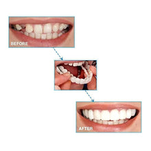 Load image into Gallery viewer, Latest👨‍⚕Adjustable Snap-On Dentures😁 (💥50% OFF) - 🔥HOT SALE🔥🎉