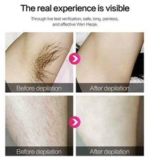 Load image into Gallery viewer, Tweez Hair Remover