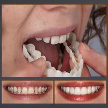 Load image into Gallery viewer, Latest👨‍⚕Adjustable Snap-On Dentures😁 (💥50% OFF) - 🔥HOT SALE🔥🎉