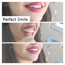 Load image into Gallery viewer, Magic Smile Teeth Brace