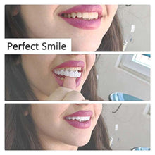 Load image into Gallery viewer, Latest👨‍⚕Adjustable Snap-On Dentures😁 (💥50% OFF) - 🔥HOT SALE🔥🎉