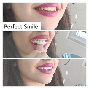 Latest👨‍⚕Adjustable Snap-On Dentures😁 (💥50% OFF) - 🔥HOT SALE🔥🎉